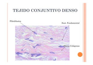 TEJIDO CONJUNTIVO DENSO 
Sust. Fundamental 
Fibras Colágenas 
Fibroblastos 
 