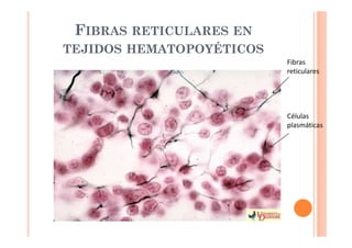 FIBRAS RETICULARES EN 
TEJIDOS HEMATOPOYÉTICOS 
Fibras 
reticulares 
Células 
plasmáticas 
 