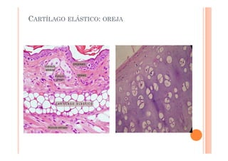 CARTÍLAGO ELÁSTICO: OREJA 
 