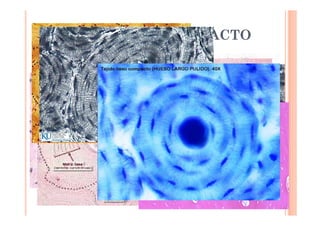 TEJIDO ÓSEOS COMPACTO 
 Formado por los Sistemas de Havers 
 Laminillas óseas (4-20) 
 Alrededor hay un hueco central = Canal de Havers 
 Vasos sanguíneos 
 Osteocitos en pequeños huecos o lagunas óseas 
 Se comunican entre sí: Conductos transversales =C. Volkman 
 