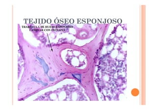 TEJIDO ÓSEO ESPONJOSO 
 Epífisis de los huesos largos 
 Interior de huesos cortos y planos 
 Estructura esponjosa 
 SI no está ordenada concéntricamente 
 Con huecos 
 Ocupados por Tej.Conjuntivo Reticular 
 Médula ósea o roja Células sanguíneas 
 