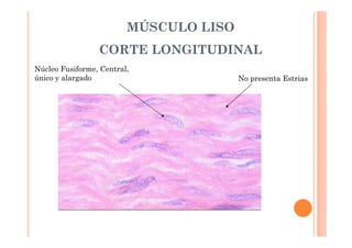 MÚSCULO LISO 
CORTE LONGITUDINAL 
Núcleo Fusiforme, Central, 
único y alargado No presenta Estrias 
 