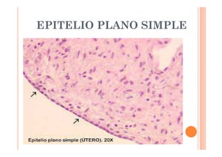 EPITELIO PLANO SIMPLE 
 