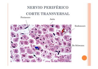 NERVIO PERIFÉRICO 
CORTE TRANSVERSAL 
Perineuro 
Endoneuro 
Axón 
Cel. De Schwann 
 
