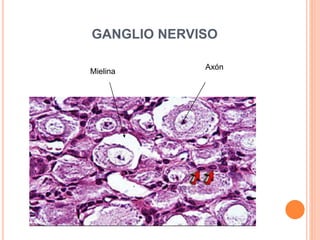 GANGLIO NERVISO
Axón
Mielina
 