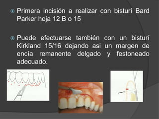    Primera incisión a realizar con bisturí Bard
    Parker hoja 12 B o 15

   Puede efectuarse también con un bisturí
    Kirkland 15/16 dejando asi un margen de
    encía remanente delgado y festoneado
    adecuado.
 