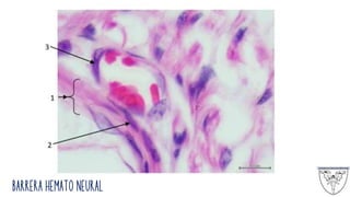 Barrera Hemato Neural
 
