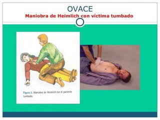 OVACE.pdf