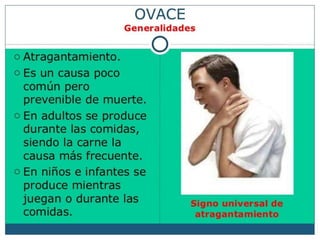 OVACE.pdf