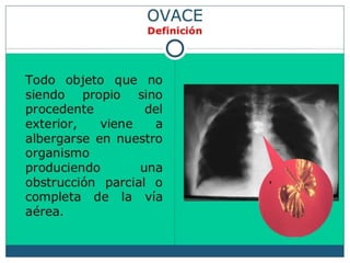 OVACE.pdf