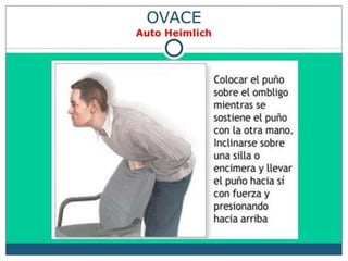 OVACE.pdf