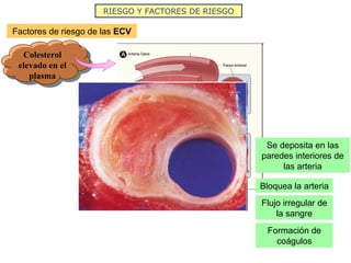 Factores de riesgo de las  ECV Colesterol elevado en el plasma RIESGO Y FACTORES DE RIESGO Se deposita en las paredes interiores de las arteria Bloquea la arteria Flujo irregular de la sangre Formación de coágulos 
