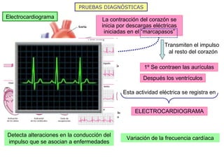 PRUEBAS DIAGNÓSTICAS Electrocardiograma La contracción del corazón se inicia por descargas eléctricas iniciadas en el “marcapasos” Transmiten el impulso al resto del corazón  1º Se contraen las aurículas Después los ventrículos Esta actividad eléctrica se registra en ELECTROCARDIOGRAMA Detecta alteraciones en la conducción del impulso que se asocian a enfermedades Variación de la frecuencia cardíaca 