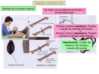 PRUEBAS DIAGNÓSTICAS Medida de la presión arterial Se mide con el esfigmomanómetro y el fonendoscopio Presión máxima ( sistólica ): Presión cuando se contrae el corazón Presión mínima ( diastólica ): Presión cuando el corazón está relajado Hipertensión : A partir de máxima 140 mmHg y mínimA 90 mmHg 