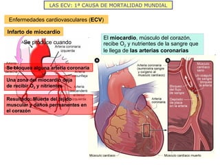 LAS ECV: 1ª CAUSA DE MORTALIDAD MUNDIAL Enfermedades cardiovasculares ( ECV ) Infarto de miocardio El  miocardio , músculo del corazón, recibe O 2  y nutrientes de la sangre que le llega de  las arterias coronarias Se produce cuando Se bloquea alguna arteria coronaria Una zona del miocardio deja de recibir O 2  y nitrientes Resultado: Muerte del tejido muscular y daños permanentes en el corazón 