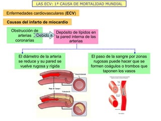 El diámetro de la arteria se reduce y su pared se vuelve rugosa y rígida El paso de la sangre por zonas rugosas puede hacer que se formen coágulos o trombos que taponen los vasos LAS ECV: 1ª CAUSA DE MORTALIDAD MUNDIAL Enfermedades cardiovasculares ( ECV ) Causas del infarto de miocardio Obstrucción de arterias coronarias Depósito de lípidos en la pared interna de las arterias Debido a 