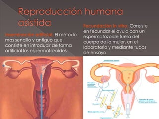 Reproducción humana asistidaFecundación in vitro. Consiste en fecundar el ovulo con un espermatozoide fuera del cuerpo de la mujer, en el laboratorio y mediante tubos de ensayoInseminación artificial. El método mas sencillo y antiguo que consiste en introducir de forma artificial los espermatozoides
