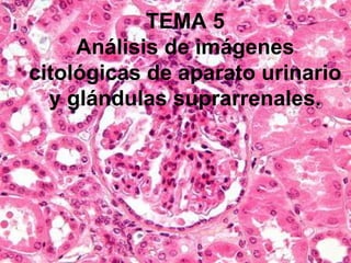 TEMA 5
Análisis de imágenes
citológicas de aparato urinario
y glándulas suprarrenales.
 