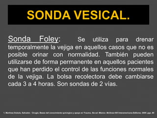 1. Martínez Dubois, Salvador. Cirugía. Bases del conocimiento quirúrgico y apoyo en Trauma. 5ta ed. México: McGraw-Hill Interamericana Editores; 2005. pgs. 80
Sonda Foley: Se utiliza para drenar
temporalmente la vejiga en aquellos casos que no es
posible orinar con normalidad. También pueden
utilizarse de forma permanente en aquellos pacientes
que han perdido el control de las funciones normales
de la vejiga. La bolsa recolectora debe cambiarse
cada 3 a 4 horas. Son sondas de 2 vías.
 