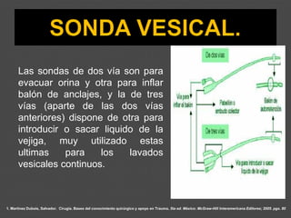 1. Martínez Dubois, Salvador. Cirugía. Bases del conocimiento quirúrgico y apoyo en Trauma. 5ta ed. México: McGraw-Hill Interamericana Editores; 2005. pgs. 80
Las sondas de dos vía son para
evacuar orina y otra para inflar
balón de anclajes, y la de tres
vías (aparte de las dos vías
anteriores) dispone de otra para
introducir o sacar liquido de la
vejiga, muy utilizado estas
ultimas para los lavados
vesicales continuos.
 