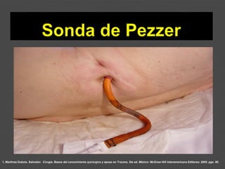 1. Martínez Dubois, Salvador. Cirugía. Bases del conocimiento quirúrgico y apoyo en Trauma. 5ta ed. México: McGraw-Hill Interamericana Editores; 2005. pgs. 80.
 