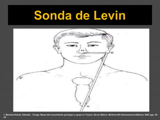 1. Martínez Dubois, Salvador. Cirugía. Bases del conocimiento quirúrgico y apoyo en Trauma. 5ta ed. México: McGraw-Hill Interamericana Editores; 2005. pgs. 30-
42.
 