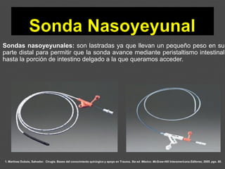 1. Martínez Dubois, Salvador. Cirugía. Bases del conocimiento quirúrgico y apoyo en Trauma. 5ta ed. México: McGraw-Hill Interamericana Editores; 2005. pgs. 80.
Sondas nasoyeyunales: son lastradas ya que llevan un pequeño peso en su
parte distal para permitir que la sonda avance mediante peristaltismo intestinal
hasta la porción de intestino delgado a la que queramos acceder.
 