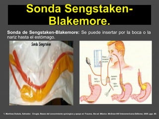 1. Martínez Dubois, Salvador. Cirugía. Bases del conocimiento quirúrgico y apoyo en Trauma. 5ta ed. México: McGraw-Hill Interamericana Editores; 2005. pgs. 80.
Sonda de Sengstaken-Blakemore: Se puede insertar por la boca o la
nariz hasta el estómago.
 