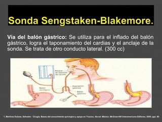 1. Martínez Dubois, Salvador. Cirugía. Bases del conocimiento quirúrgico y apoyo en Trauma. 5ta ed. México: McGraw-Hill Interamericana Editores; 2005. pgs. 80.
Vía del balón gástrico: Se utiliza para el inflado del balón
gástrico, logra el taponamiento del cardias y el anclaje de la
sonda. Se trata de otro conducto lateral. (300 cc)
 