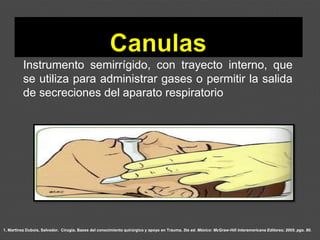 1. Martínez Dubois, Salvador. Cirugía. Bases del conocimiento quirúrgico y apoyo en Trauma. 5ta ed. México: McGraw-Hill Interamericana Editores; 2005. pgs. 80.
Instrumento semirrígido, con trayecto interno, que
se utiliza para administrar gases o permitir la salida
de secreciones del aparato respiratorio
 
