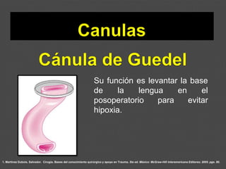 1. Martínez Dubois, Salvador. Cirugía. Bases del conocimiento quirúrgico y apoyo en Trauma. 5ta ed. México: McGraw-Hill Interamericana Editores; 2005. pgs. 80.
Su función es levantar la base
de la lengua en el
posoperatorio para evitar
hipoxia.
 
