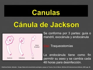 1. Martínez Dubois, Salvador. Cirugía. Bases del conocimiento quirúrgico y apoyo en Trauma. 5ta ed. México: McGraw-Hill Interamericana Editores; 2005. pgs. 80.
Se conforma por 3 partes: guía o
mandril, exocánula y endocánula
Uso: Traqueostomías
La endocánula tiene como fin
permitir su aseo y se cambia cada
48 horas para desinfección.
 