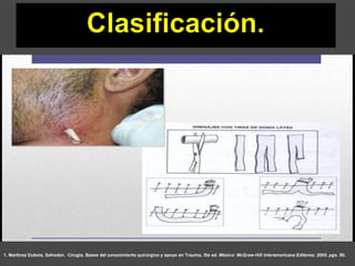 1. Martínez Dubois, Salvador. Cirugía. Bases del conocimiento quirúrgico y apoyo en Trauma. 5ta ed. México: McGraw-Hill Interamericana Editores; 2005. pgs. 80.
 
