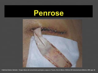 1. Martínez Dubois, Salvador. Cirugía. Bases del conocimiento quirúrgico y apoyo en Trauma. 5ta ed. México: McGraw-Hill Interamericana Editores; 2005. pgs. 80.
 