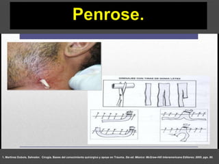 1. Martínez Dubois, Salvador. Cirugía. Bases del conocimiento quirúrgico y apoyo en Trauma. 5ta ed. México: McGraw-Hill Interamericana Editores; 2005. pgs. 80.
 