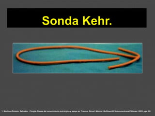 1. Martínez Dubois, Salvador. Cirugía. Bases del conocimiento quirúrgico y apoyo en Trauma. 5ta ed. México: McGraw-Hill Interamericana Editores; 2005. pgs. 80.
 