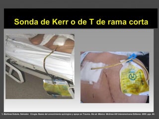 1. Martínez Dubois, Salvador. Cirugía. Bases del conocimiento quirúrgico y apoyo en Trauma. 5ta ed. México: McGraw-Hill Interamericana Editores; 2005. pgs. 80.
 