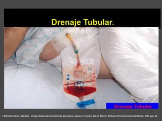 1. Martínez Dubois, Salvador. Cirugía. Bases del conocimiento quirúrgico y apoyo en Trauma. 5ta ed. México: McGraw-Hill Interamericana Editores; 2005. pgs. 80.
 