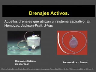 1. Martínez Dubois, Salvador. Cirugía. Bases del conocimiento quirúrgico y apoyo en Trauma. 5ta ed. México: McGraw-Hill Interamericana Editores; 2005. pgs. 80.
Aquellos drenajes que utilizan un sistema aspirativo. Ej:
Hemovac, Jackson-Pratt, J-Vac
Jackson-Pratt- Biovac
Hemovac-Sistema
de acordeon
 