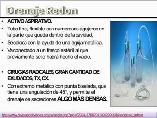 • ACTIVOASPIRATIVO.
• Tubofino, flexible con numerosos agujerosen
la parte que queda dentro de lacavidad.
• Secoloca con la ayuda de una agujametálica.
• Vaconectado aun frasco estéril al que
previamente sele habrá hecho el vacío.
• CIRUGIASRADICALES,GRANCANTIDAD DE
EXUDADOS,TX,CX.
• Conextremo metálico con punta biselada, que
tiene una angulación de 45°, y permite el
drenaje de secreciones ALGOMÁSDENSAS.
http://www.revistasbolivianas.org.bo/scielo.php?pid=S2304-37682011001200008&script=sci_arttext
 