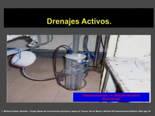 1. Martínez Dubois, Salvador. Cirugía. Bases del conocimiento quirúrgico y apoyo en Trauma. 5ta ed. México: McGraw-Hill Interamericana Editores; 2005. pgs. 80.
 
