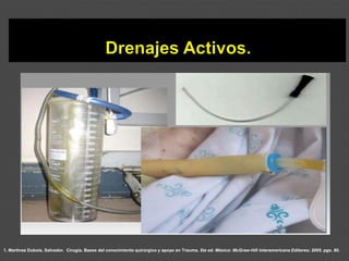 1. Martínez Dubois, Salvador. Cirugía. Bases del conocimiento quirúrgico y apoyo en Trauma. 5ta ed. México: McGraw-Hill Interamericana Editores; 2005. pgs. 80.
 