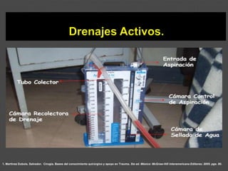 1. Martínez Dubois, Salvador. Cirugía. Bases del conocimiento quirúrgico y apoyo en Trauma. 5ta ed. México: McGraw-Hill Interamericana Editores; 2005. pgs. 80.
 