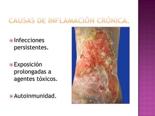  Infecciones
 persistentes.

 Exposición
 prolongadas a
 agentes tóxicos.

 Autoinmunidad.
 