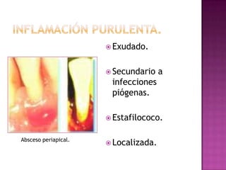  Exudado.


                       Secundario    a
                       infecciones
                       piógenas.

                       Estafilococo.


Absceso periapical.
                       Localizada.
 