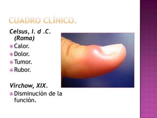 Celsus, I. d .C.
  (Roma)
 Calor.
 Dolor.
 Tumor.
 Rubor.


Virchow, XIX.
 Disminución de la
  función.
 