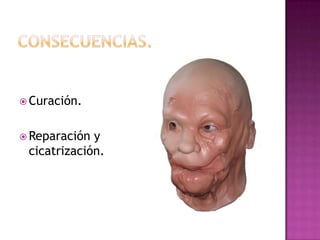  Curación.


 Reparación y
 cicatrización.
 