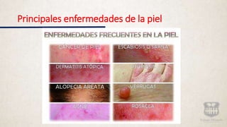 Principales enfermedades de la piel
 