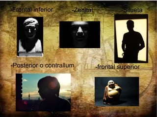 -Posterior o contrallum
-Frontal inferior
-frontal superior
-Silueta-Zenital
 