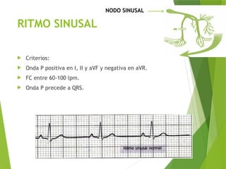 Comprehensive Guide to Electrocardiogram (ECG) Interpretation and ...